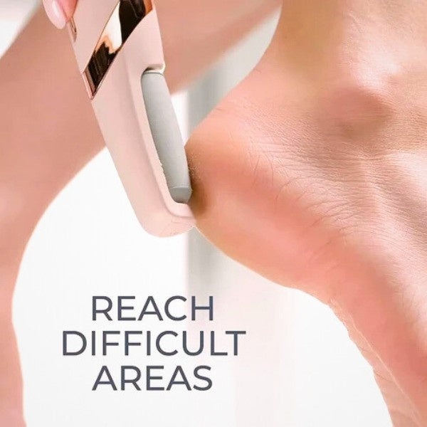 Electric Callus Remover